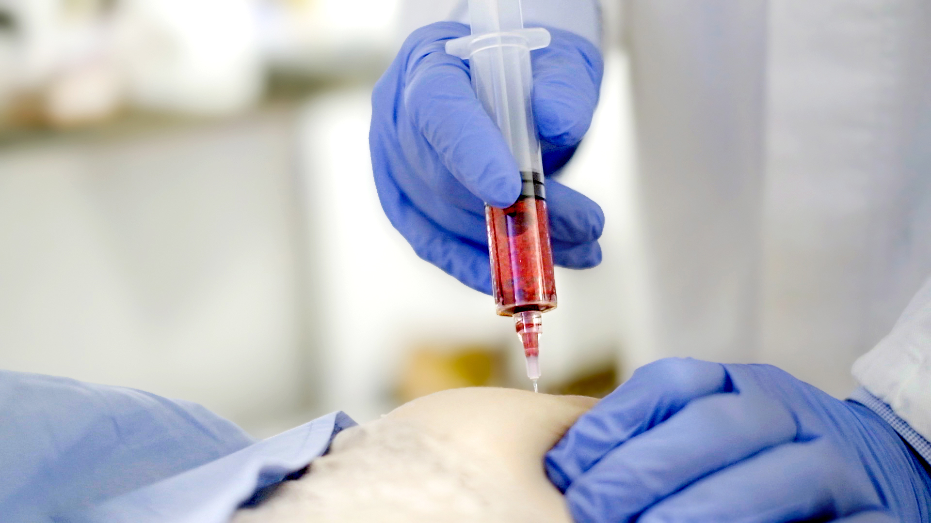 Ozonoterapia